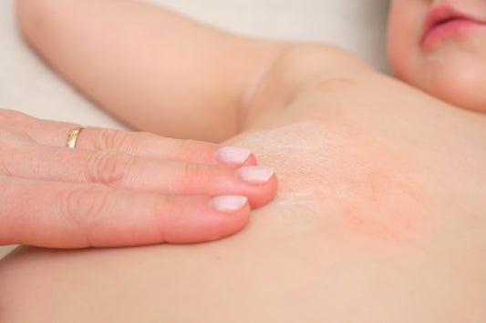 The Surprising Benefits of Beef Tallow for Eczema